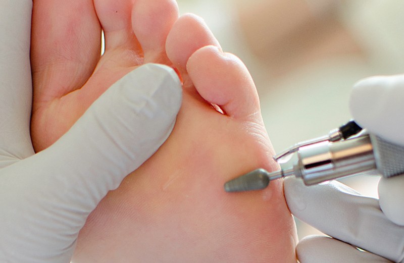 Pedicure verwijdert eelt met een frees, met handschoenen